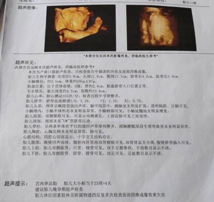 怀孕4个月,B超检查胎儿只有一个肾,胎儿肾正常值 第2张 怀孕4个月,B超检查胎儿只有一个肾,胎儿肾正常值 第2张