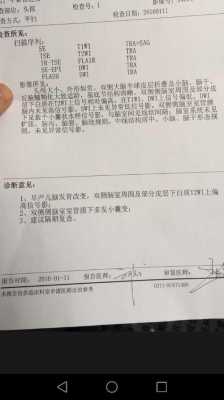 胎儿磁共振多久出结果(婴儿做磁共振怎么做) 第2张 胎儿磁共振多久出结果(婴儿做磁共振怎么做) 第2张