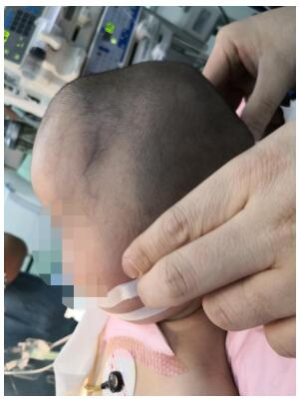 胎儿头圆（一岁宝宝的头型正常是什么样的）  第2张