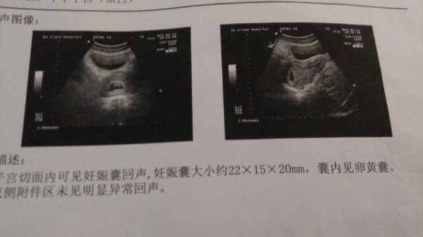 孕期第一天(上班第一天发现怀孕了怎么辞) 第3张 孕期第一天(上班第一天发现怀孕了怎么辞) 第3张