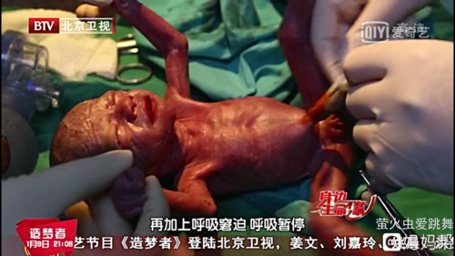 29周宝宝在肚子里的样子,怀孕29周胎儿图片真人 第2张 29周宝宝在肚子里的样子,怀孕29周胎儿图片真人 第2张
