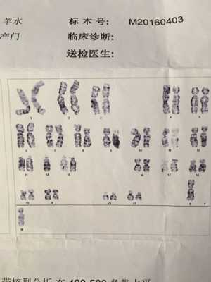 什么是胎儿染色体（胎染是什么）  第2张