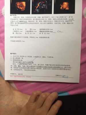 胎儿强光点是什么意思(孕23周4天检查胎儿左心室可见一枚长约0.2CM强光点是什么意思) 第3张 胎儿强光点是什么意思(孕23周4天检查胎儿左心室可见一枚长约0.2CM强光点是什么意思) 第3张
