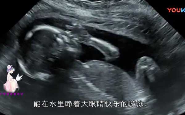 胎宝宝在肚子里会睁眼吗,胎儿会睁开眼睛吗图片 第1张 胎宝宝在肚子里会睁眼吗,胎儿会睁开眼睛吗图片 第1张