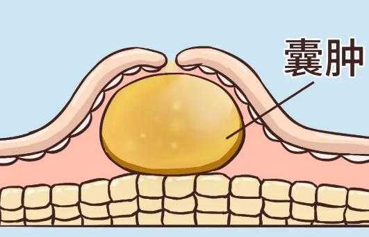 孕期有囊肿(囊肿怀孕25周要注意什么) 第2张 孕期有囊肿(囊肿怀孕25周要注意什么) 第2张