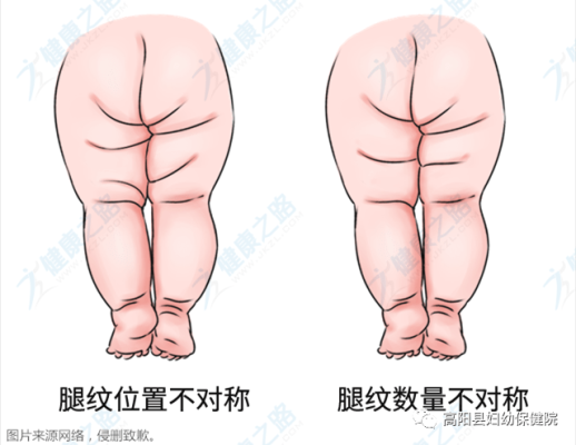 怎么看胎儿腿长不长(怎么看胎儿腿长不长?) 第3张 怎么看胎儿腿长不长(怎么看胎儿腿长不长?) 第3张