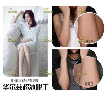 备孕期间可以激光脱毛吗(备孕期间可以激光脱毛吗) 第1张 备孕期间可以激光脱毛吗(备孕期间可以激光脱毛吗) 第1张