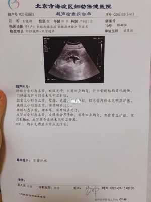孕晚期如果查出肾不好对宝宝有影响吗,胎儿肾不好是什么原因引起的 第1张 孕晚期如果查出肾不好对宝宝有影响吗,胎儿肾不好是什么原因引起的 第1张