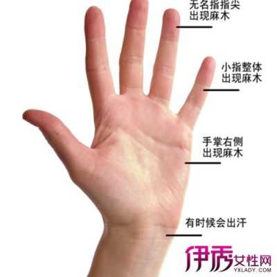 孕妇手指头麻是怎么回事,孕期手指麻木是什么原因引起的 第1张 孕妇手指头麻是怎么回事,孕期手指麻木是什么原因引起的 第1张