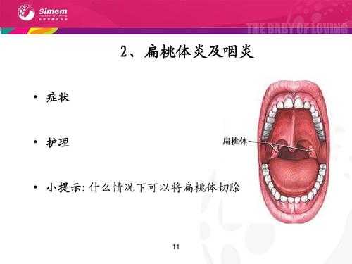 咽炎对胎儿有影响吗(孕妇咽炎对胎儿有影响吗) 第1张 咽炎对胎儿有影响吗(孕妇咽炎对胎儿有影响吗) 第1张