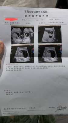 怀孕九周胎儿有多大(孕9周如何判断胎儿正常,要做什么检查) 第1张 怀孕九周胎儿有多大(孕9周如何判断胎儿正常,要做什么检查) 第1张