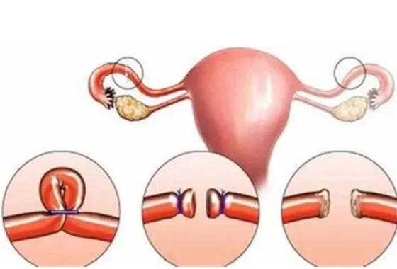 怀孕期间可以做手术吗（怀孕期间可以做手术吗?）  第2张