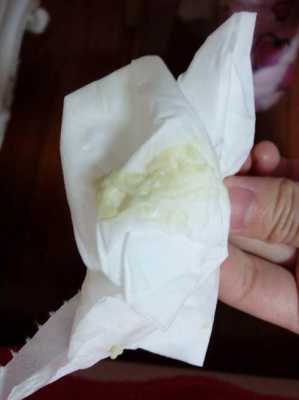 孕期霉菌是什么症状(孕妇白带检查霉菌为阳性有问题吗) 第1张 孕期霉菌是什么症状(孕妇白带检查霉菌为阳性有问题吗) 第1张