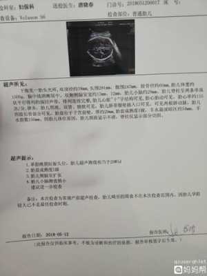 胎儿小脑发育偏小(胎儿小脑发育偏小) 第2张 胎儿小脑发育偏小(胎儿小脑发育偏小) 第2张