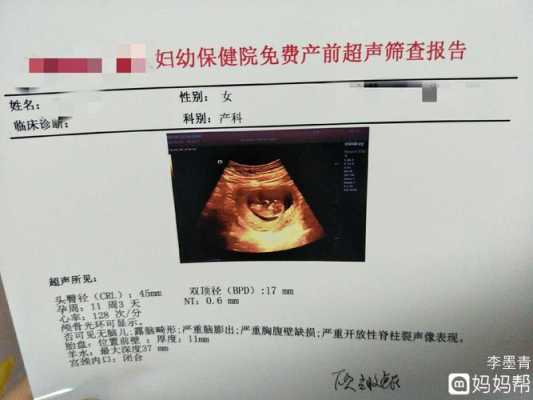 孕11周有羊水了吗?胎盘形成了吗,孕十一周胎儿多大 第2张 孕11周有羊水了吗?胎盘形成了吗,孕十一周胎儿多大 第2张