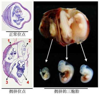 胎儿生化是什么意思(孕妇胎儿生化是什么意思) 第1张 胎儿生化是什么意思(孕妇胎儿生化是什么意思) 第1张