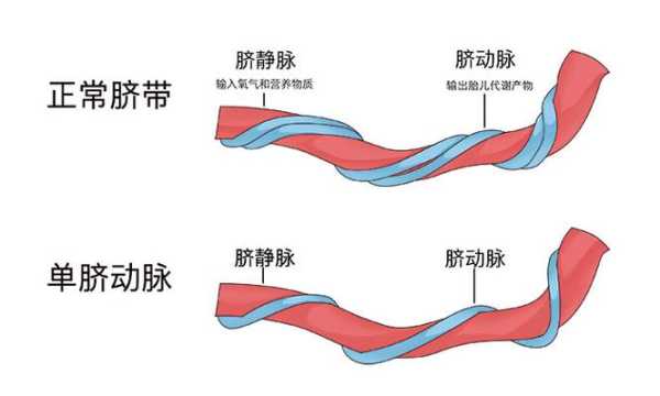 胎儿脐血管（新生儿脐带的结构是）  第2张