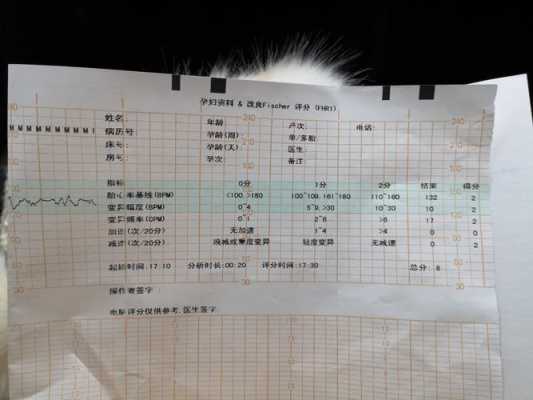 胎心监护胎儿评分8分是什么意思啊,胎儿生物评分是什么 第2张 胎心监护胎儿评分8分是什么意思啊,胎儿生物评分是什么 第2张