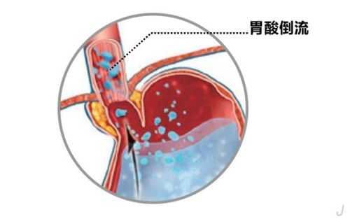 宝宝在肚子里几个月长头发,怀孕几个月胎儿长头发开始烧心 第1张 宝宝在肚子里几个月长头发,怀孕几个月胎儿长头发开始烧心 第1张