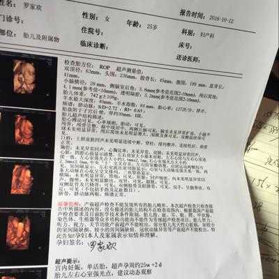 胎儿心脏彩超有强光点(胎儿右心室有强光点) 第2张 胎儿心脏彩超有强光点(胎儿右心室有强光点) 第2张