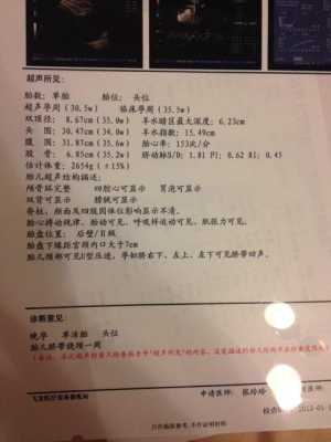35周胎儿彩超(怀孕35周要做什么检查) 第2张 35周胎儿彩超(怀孕35周要做什么检查) 第2张