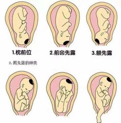 怀孕期间不小心碰到了腰,宝宝会受到影响吗,胎儿在腰部动什么胎位 第1张 怀孕期间不小心碰到了腰,宝宝会受到影响吗,胎儿在腰部动什么胎位 第1张