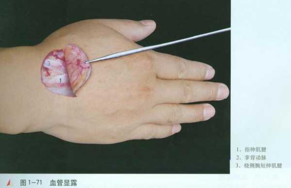 胎儿动脉细(手背静脉管突然变细是什么原因) 第2张 胎儿动脉细(手背静脉管突然变细是什么原因) 第2张