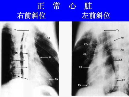 胎儿右心大(胎儿右心大于左心正常吗?) 第2张 胎儿右心大(胎儿右心大于左心正常吗?) 第2张