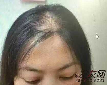 孕期头发变多,怀孕期间掉头发正常吗女性 第1张 孕期头发变多,怀孕期间掉头发正常吗女性 第1张