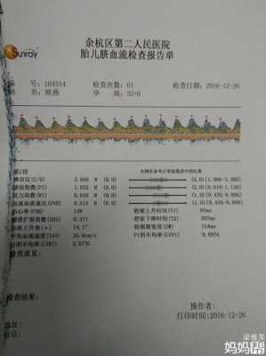 脐血流是检查胎儿什么（脐血流是检查胎儿什么意思）  第2张