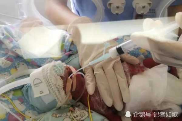两月胎儿(两个月的宝宝才长两斤正常吗?给宝宝吃什么长肉快) 第2张 两月胎儿(两个月的宝宝才长两斤正常吗?给宝宝吃什么长肉快) 第2张