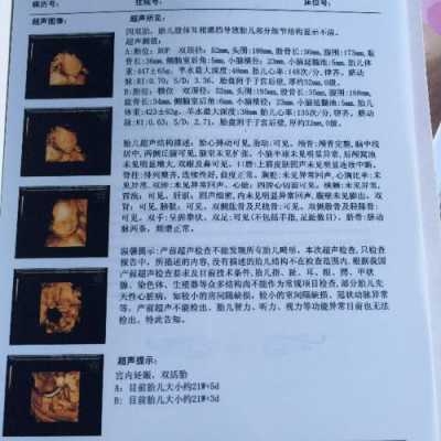 怀孕22周+4天做四维彩超,发现图片上的胎儿头部中间有条缝隙,这是正常的吗,胎儿22周图片欣赏 第1张 怀孕22周+4天做四维彩超,发现图片上的胎儿头部中间有条缝隙,这是正常的吗,胎儿22周图片欣赏 第1张