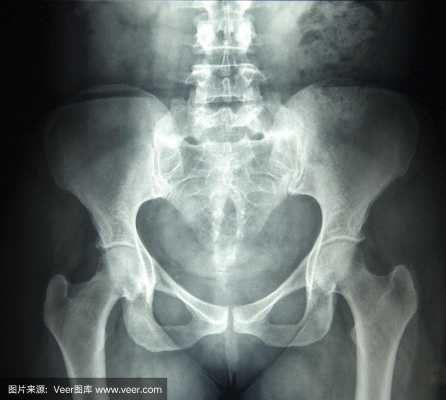 孕期拍片了(孕妇拍了x光怎么办,一次x线对孕早期有什么影响) 第2张 孕期拍片了(孕妇拍了x光怎么办,一次x线对孕早期有什么影响) 第2张