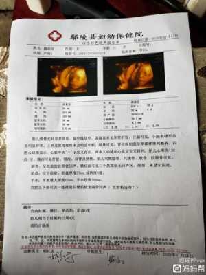 彩超对胎儿有伤害吗(彩超对胎儿有伤害吗,多久做一次) 第2张 彩超对胎儿有伤害吗(彩超对胎儿有伤害吗,多久做一次) 第2张