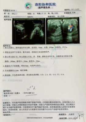 怀孕37周,做b超说胎头低是什么意思,胎儿很低在宫颈口边缘 第2张 怀孕37周,做b超说胎头低是什么意思,胎儿很低在宫颈口边缘 第2张
