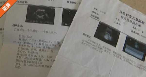 孕期b超时间表（孕期b超时间表）  第3张