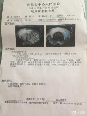 怀孕了才发现有卵巢囊肿严重吗,怀孕卵巢囊肿会影响胎儿吗 第2张 怀孕了才发现有卵巢囊肿严重吗,怀孕卵巢囊肿会影响胎儿吗 第2张