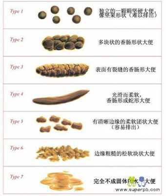 孕妇一天去3次大便是正常的吗,孕期大便次数多正常吗? 第1张 孕妇一天去3次大便是正常的吗,孕期大便次数多正常吗? 第1张