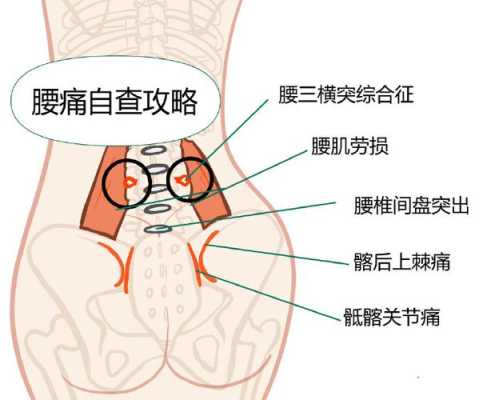 孕期腿根疼(孕妇的阴道口很疼痛是怎么回事呀?弄到大腿根都痛了,好难受呀) 第2张 孕期腿根疼(孕妇的阴道口很疼痛是怎么回事呀?弄到大腿根都痛了,好难受呀) 第2张