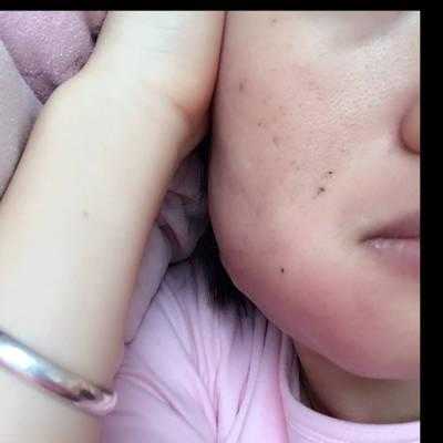 谁知道牙疼脸肿了要几天消肿呀,孕期脸肿了正常的吗 第2张 谁知道牙疼脸肿了要几天消肿呀,孕期脸肿了正常的吗 第2张