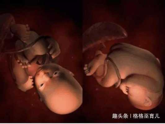 38周的胎儿是什么样子,38周胎儿图片 第2张 38周的胎儿是什么样子,38周胎儿图片 第2张