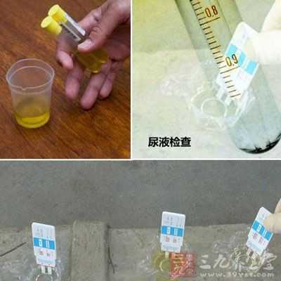 孕期验尿需要空腹吗(做尿液检测需要空腹吗) 第1张 孕期验尿需要空腹吗(做尿液检测需要空腹吗) 第1张