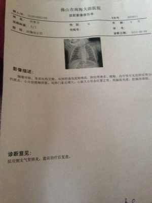 胎儿肺炎(胎儿肺炎产检可以查出来吗) 第1张 胎儿肺炎(胎儿肺炎产检可以查出来吗) 第1张