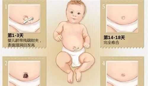 胎儿脐带图（什么是新生儿脐带）  第3张