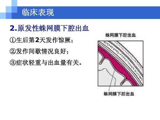 胎儿颅内出血原因(胎儿颅内出血原因有哪些) 第2张 胎儿颅内出血原因(胎儿颅内出血原因有哪些) 第2张