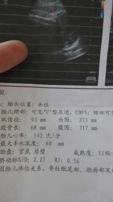 孕七个月做彩超检查胎儿头偏小腹围偏大是怎么回事,七个月的胎儿彩超检查腿短怎么回事 第2张 孕七个月做彩超检查胎儿头偏小腹围偏大是怎么回事,七个月的胎儿彩超检查腿短怎么回事 第2张