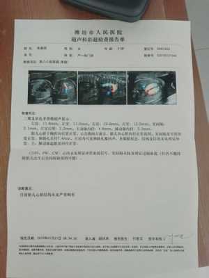 胎儿卵圆瓣(孕25周3天检查心脏 卵圆孔偏大 有坚持的必要吗) 第1张 胎儿卵圆瓣(孕25周3天检查心脏 卵圆孔偏大 有坚持的必要吗) 第1张