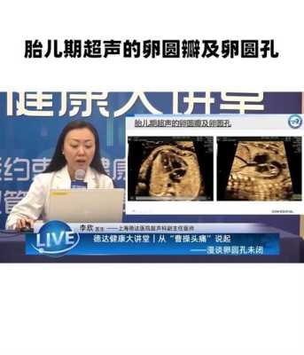 胎儿卵圆瓣(孕25周3天检查心脏 卵圆孔偏大 有坚持的必要吗) 第3张 胎儿卵圆瓣(孕25周3天检查心脏 卵圆孔偏大 有坚持的必要吗) 第3张