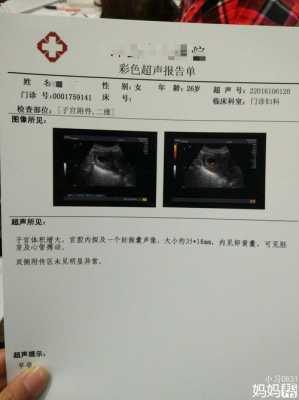 胎儿胎心170正常吗(12周胎心170正常吗) 第1张 胎儿胎心170正常吗(12周胎心170正常吗) 第1张