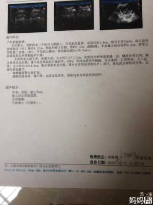 胎儿肾萎缩(左肾萎缩,不知道有没有可能恢复) 第1张 胎儿肾萎缩(左肾萎缩,不知道有没有可能恢复) 第1张